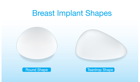 Gummy Bear (Teardrop Shaped) Breast Implants