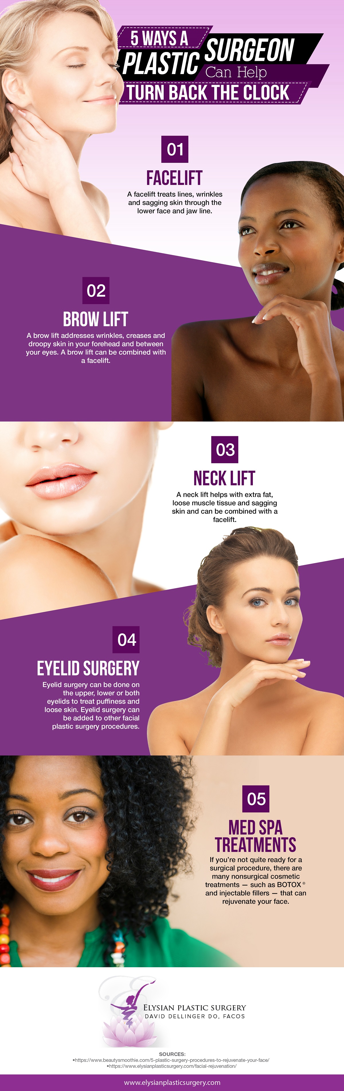 plastic surgery infographic