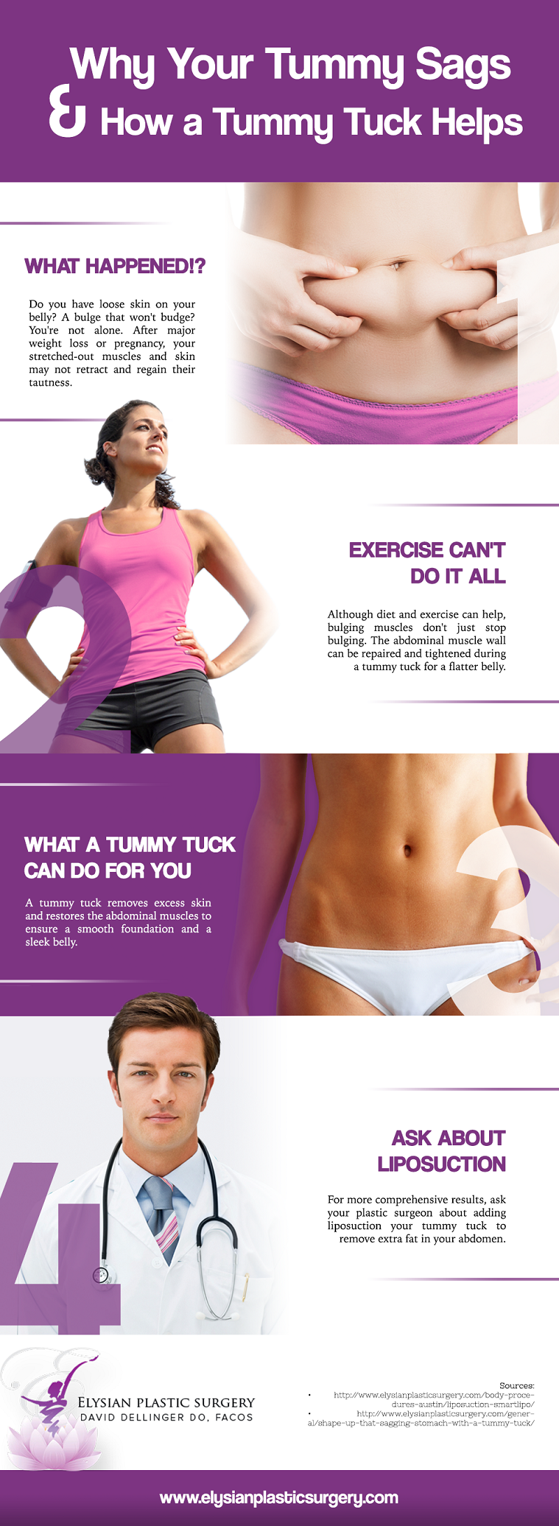 Why Your Tummy Sags and How a Tummy Tuck Helps [Infographic] img 1