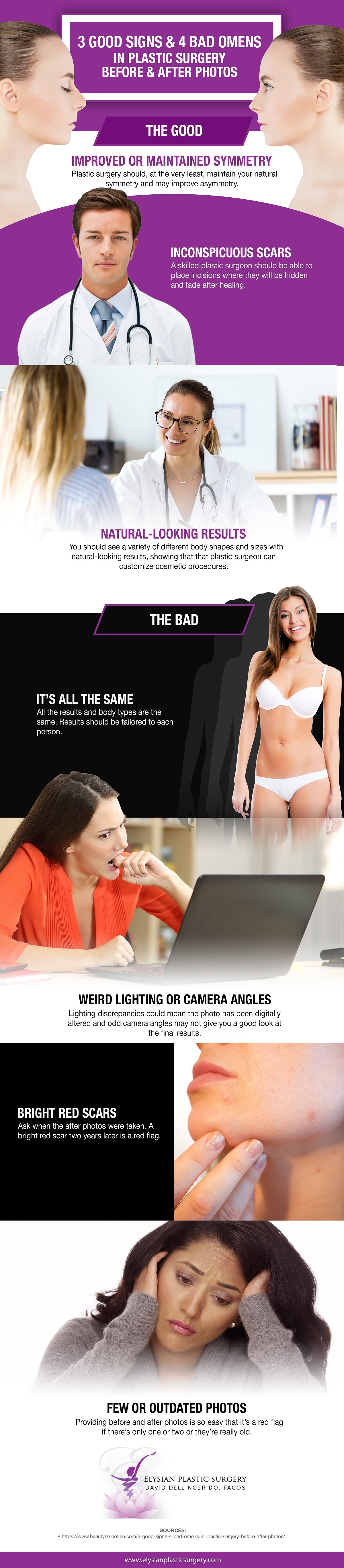 3 Good Signs & 4 Bad Omens in Plastic Surgery Before & After Photos [Infographic] img 1