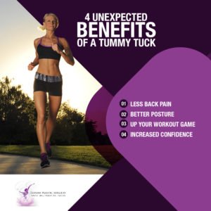 Read more about the article 4 Unexpected Benefits of a Tummy Tuck [Infographic]