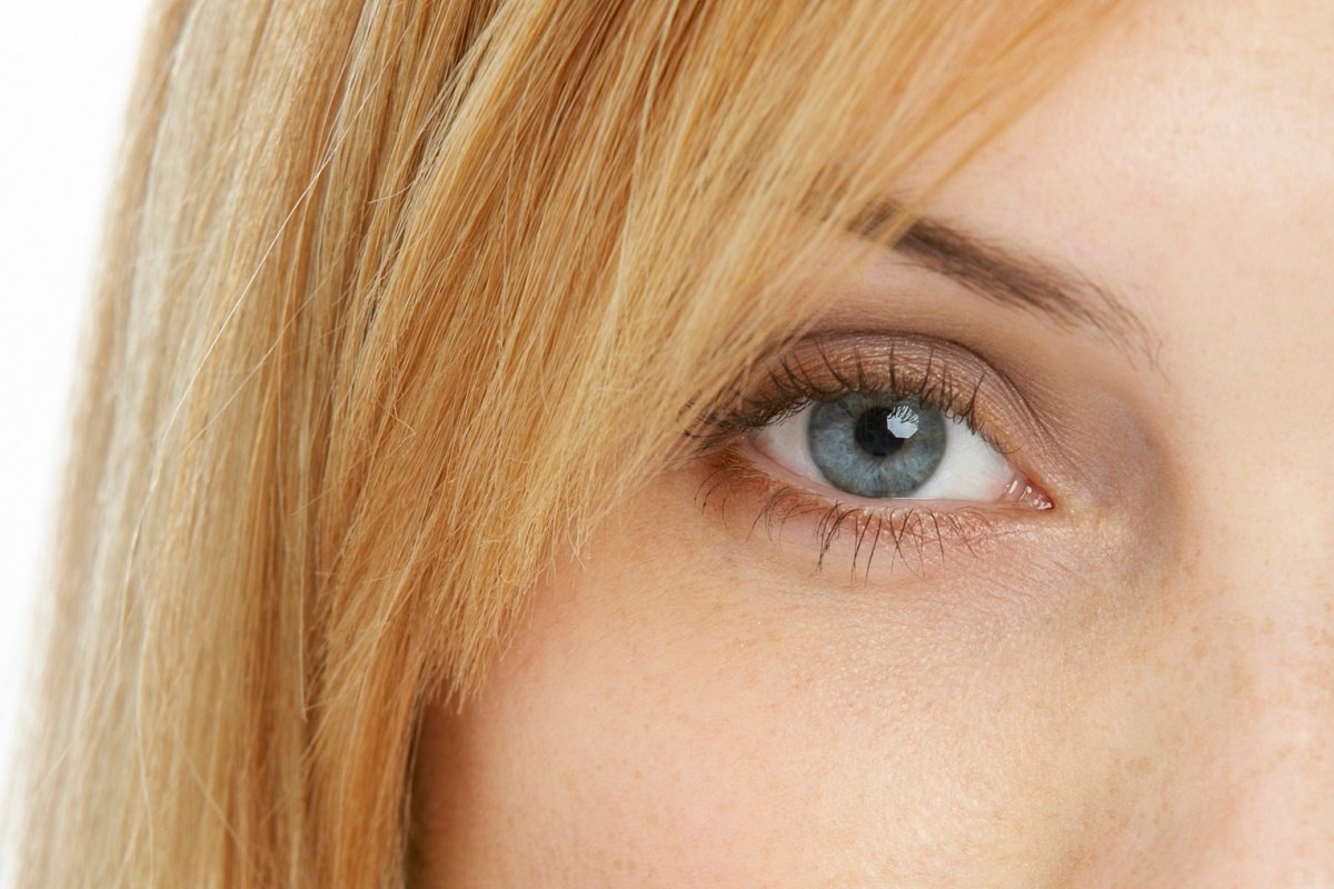 Brow Lift - Dellinger - December 2021