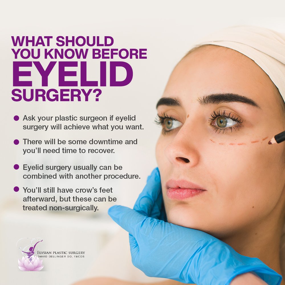 Eyelid Surgery Infographic - March2022