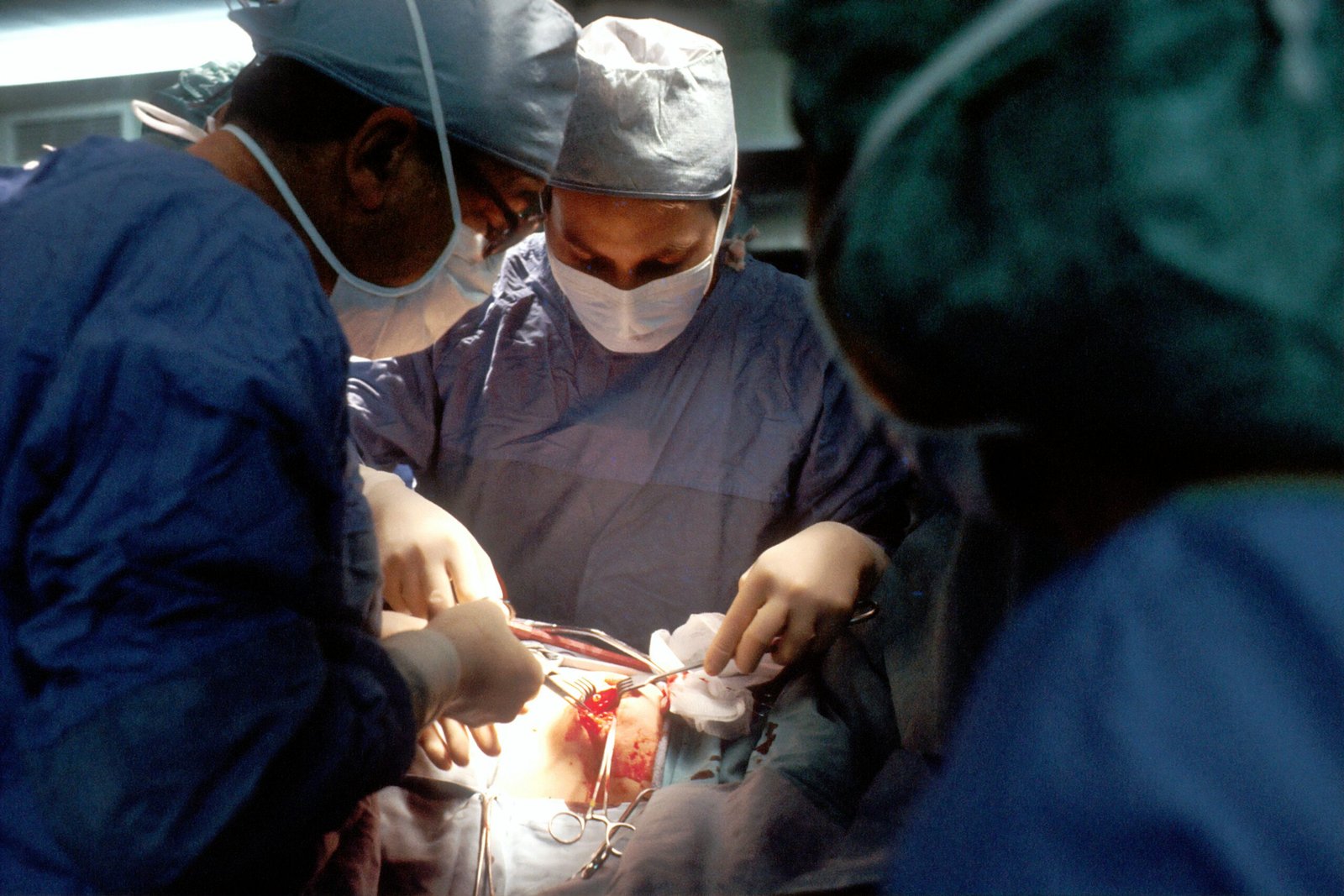 Read more about the article Panniculectomy: What You Need to Know