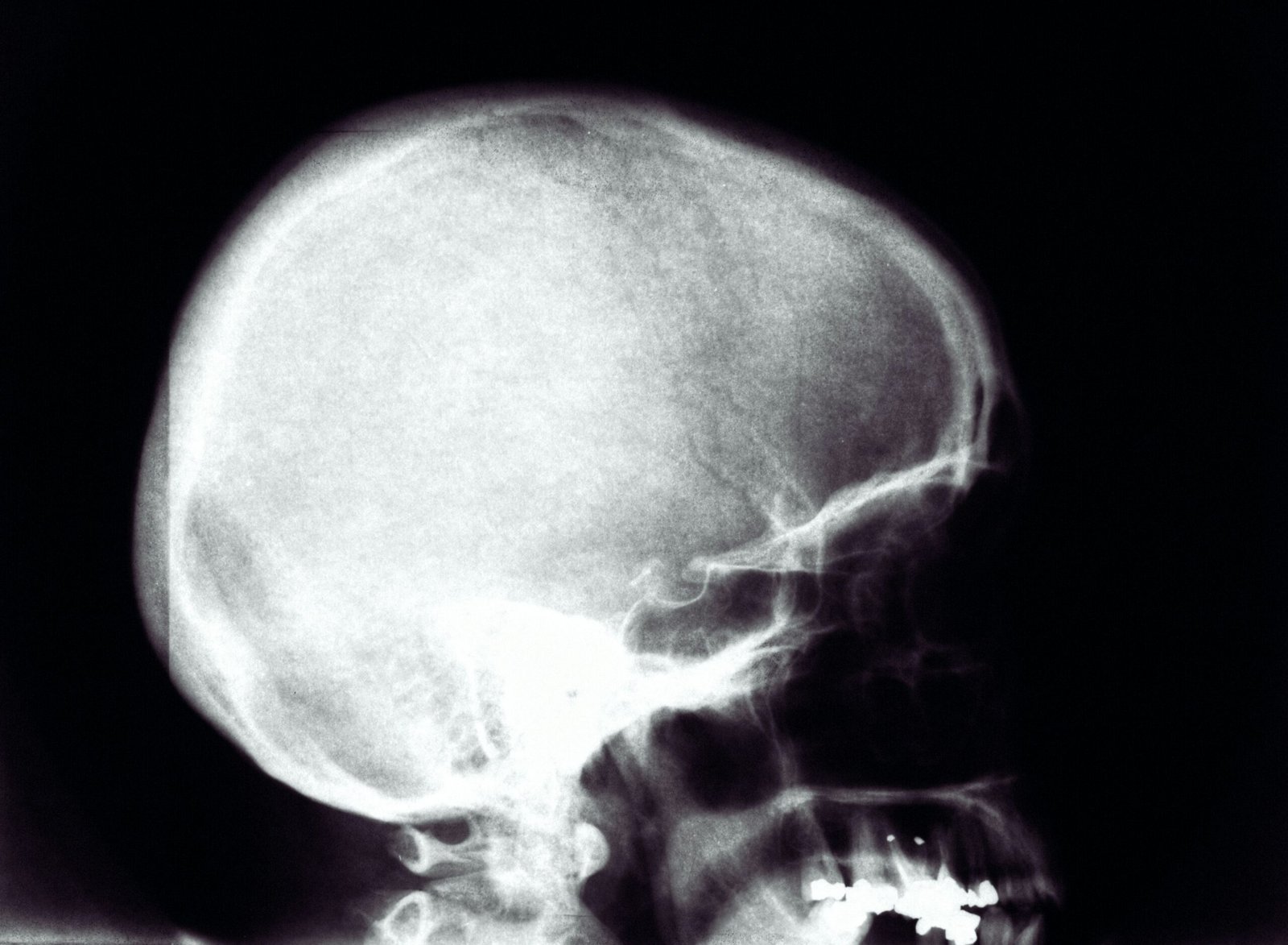 You are currently viewing Enhancing Your Figure: The Benefits of Augmentation Mammoplasty