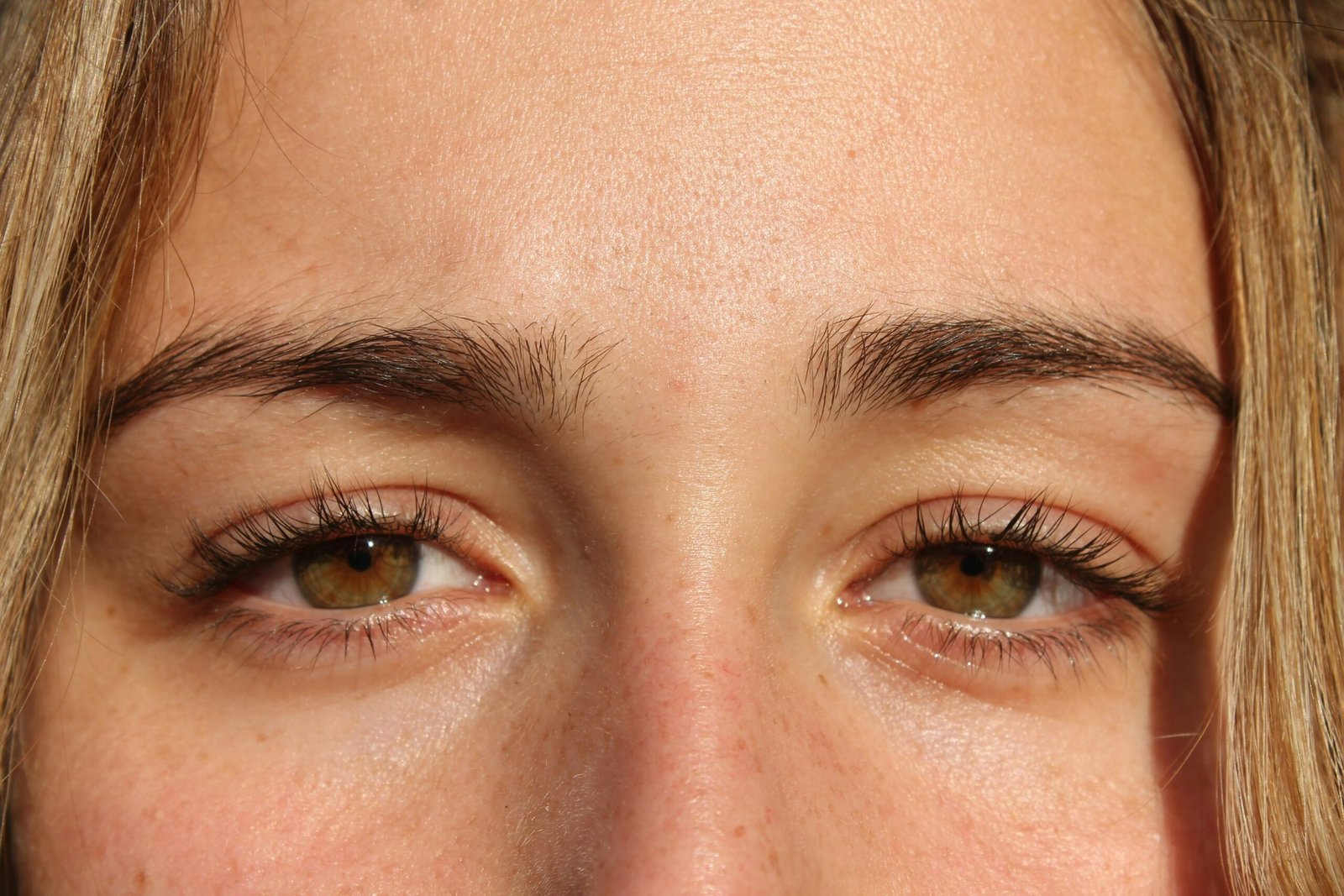 You are currently viewing The Cost of Blepharoplasty: What to Expect
